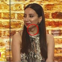 لقاء تلفزيوني يكشف “كارثة” في رقبة المذيعة